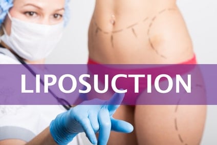 Liposuktion